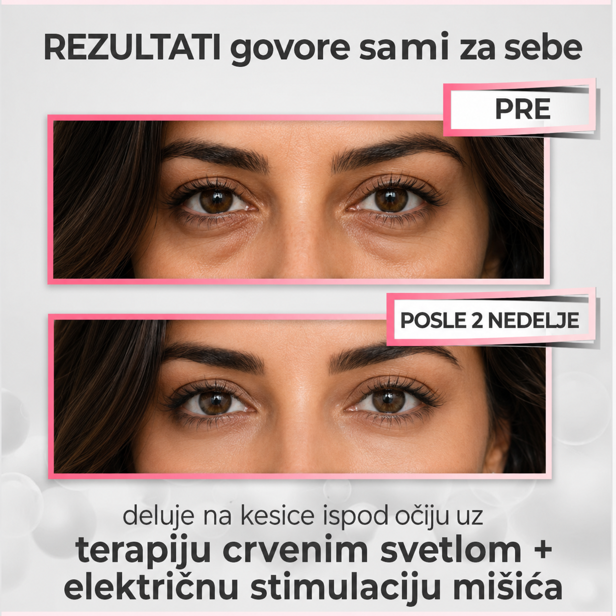 Sijana EyeLift Pro – 2-u-1 Red Light Eye Massager
