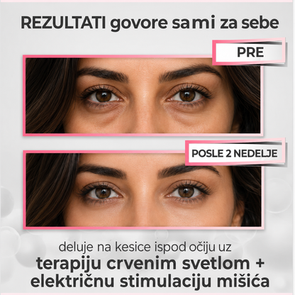 Sijana EyeLift Pro – 2-u-1 Red Light Eye Massager