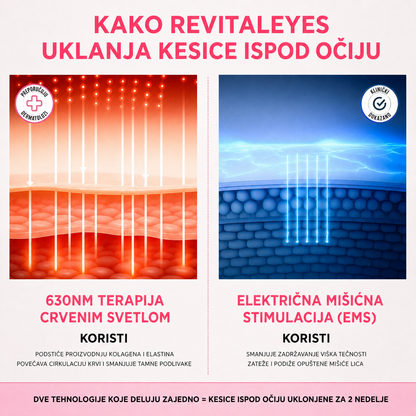 Sijana EyeLift Pro – 2-u-1 Red Light Eye Massager